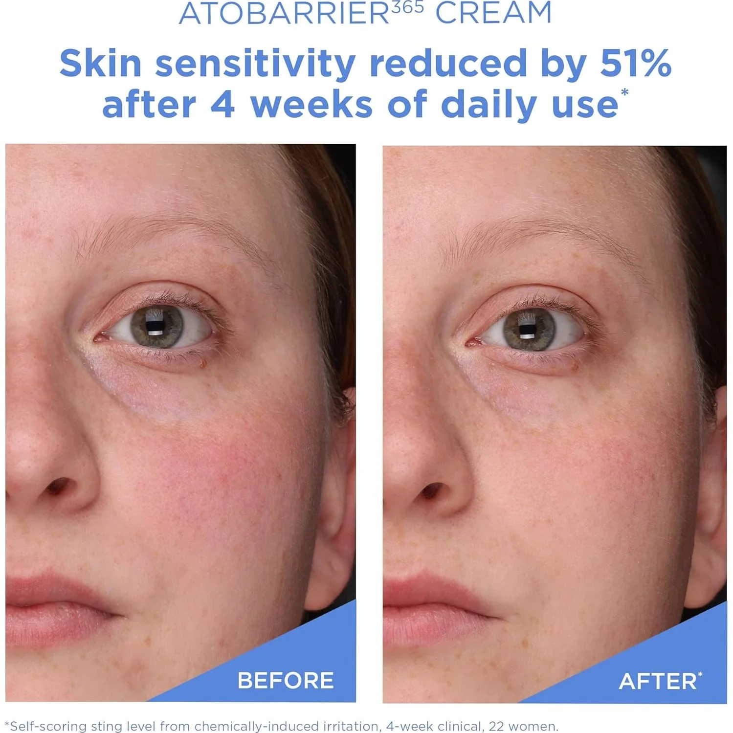 AESTURA Atobarrier 365 Cream 80ml - Image 6