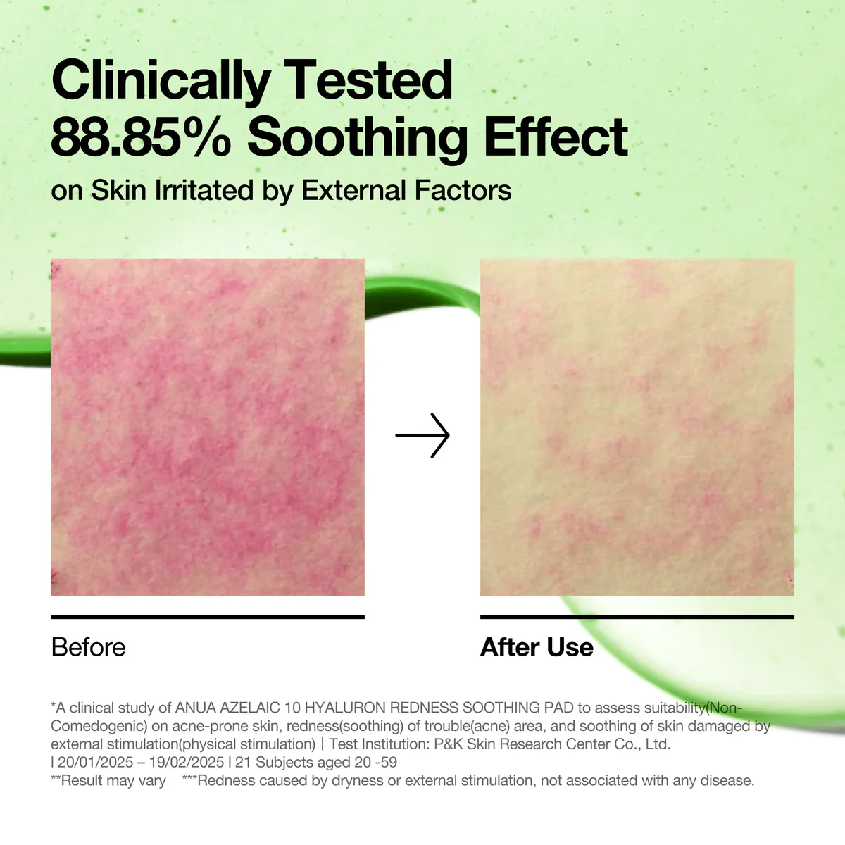 ANUA Azelaic 10 Hyaluron Redness Soothing Pad （210ml / 60pads） - Image 3