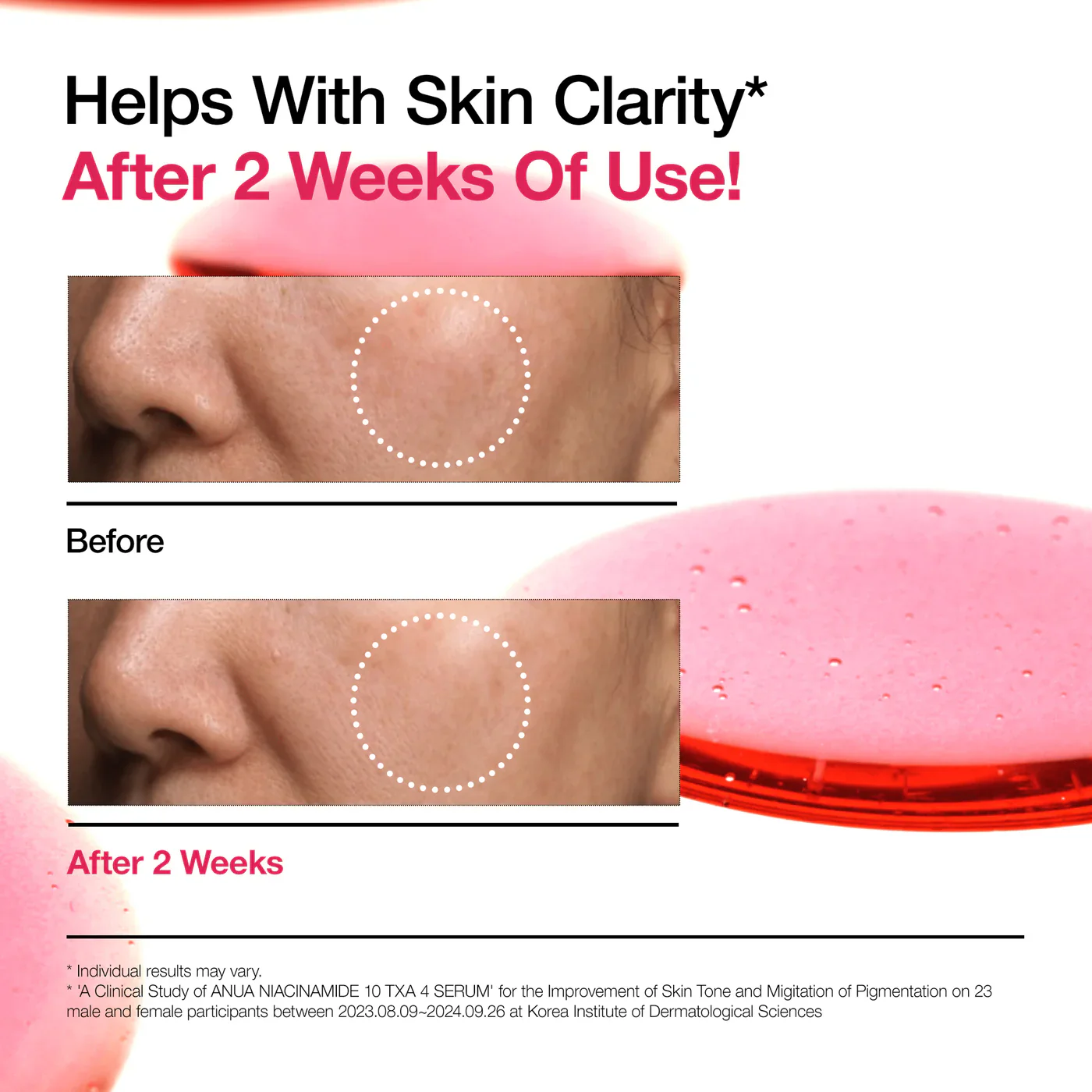 ANUA Niacinamide 10% +TXA 4% Serum 30ml - Image 4