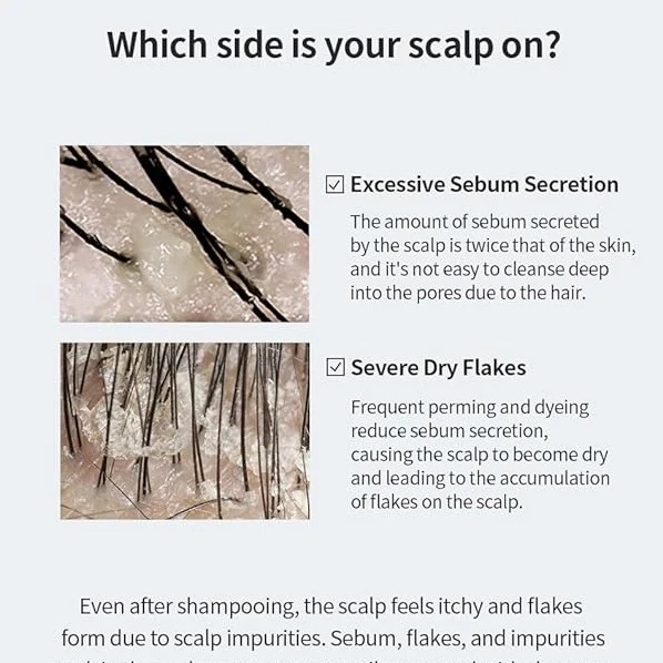 GROWUS Sea Salt Therapy Scalp Scaler 250g - Image 2