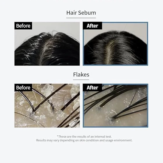 GROWUS Sea Salt Therapy Scalp Scaler 250g - Image 3