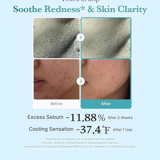 MEDICUBE Azelaic Acid Niacinamide Clarifying Toner 250ml - Image 4